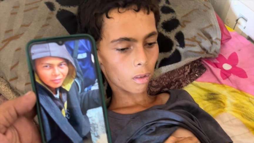 الطفل عاطف أبو خاطر.. ضحية جديدة للتجويع الإسرائيلي بغزة
